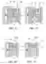 Fig. 17 - Tissue interface for implantable restriction system