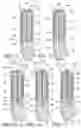 Fig. 19 - Tissue interface for implantable restriction system