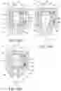 Fig. 20 - Tissue interface for implantable restriction system