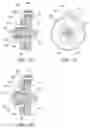 Fig. 30 - Tissue interface for implantable restriction system