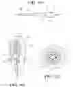 Fig. 35 - Tissue interface for implantable restriction system