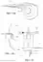 Fig. 38 - Tissue interface for implantable restriction system