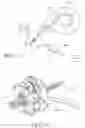 Fig. 40 - Tissue interface for implantable restriction system