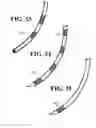 Fig. 13 - Method and Device for the Assessment of Fluid Collection Networks
