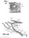 Fig. 28 - Method and Device for the Assessment of Fluid Collection Networks