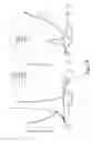 Fig. 16 - Controlled compressional wave components of thickness shear mode multi-measurand sensors