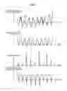 Fig. 04 - Real-time motion recognition system and method