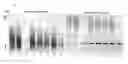 Fig. 01 - Transgenic Mouse Lacking Endogenous FVIII and VWF - A Model of Hemophilia A