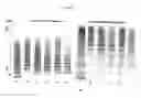 Fig. 03 - Transgenic Mouse Lacking Endogenous FVIII and VWF - A Model of Hemophilia A