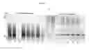 Fig. 05 - Transgenic Mouse Lacking Endogenous FVIII and VWF - A Model of Hemophilia A