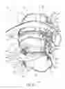 Fig. 03 - Protective helmet