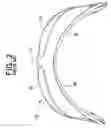 Fig. 03 - Eye protector
