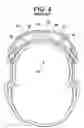 Fig. 05 - Eye protector