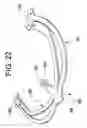Fig. 17 - Eye protector