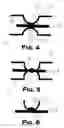 Fig. 05 - Inflatable air recoil suppressor