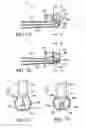 Fig. 08 - Multi-motion toothbrush