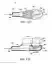 Fig. 16 - Multi-motion toothbrush