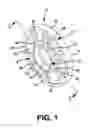 Fig. 02 - AXIAL SPACER FOR A ROTATIONAL ASSEMBLY