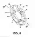 Fig. 06 - AXIAL SPACER FOR A ROTATIONAL ASSEMBLY