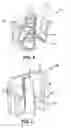 Fig. 05 - Push-on clip fastener