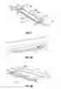 Fig. 03 - Method and system for manufacturing electrosurgical seal plates
