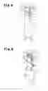 Fig. 08 - Hair remover