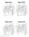 Fig. 09 - Hair remover