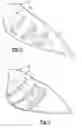 Fig. 05 - INTEGRAL INSOLE WITH MULTIPLE AREAS OF DIFFERENT RESILIENCY AND METHOD OF MAKING THE INSOLE