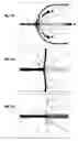 Fig. 11 - Skimmer for Concentrating an Aerosol and Uses Thereof