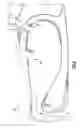 Fig. 04 - GAS TURBINE ENGINE FUEL INJECTOR