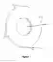 Fig. 02 - New-type thin shredder blade having blade points without steps, blade sets and manufacturing method thereof