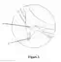 Fig. 04 - New-type thin shredder blade having blade points without steps, blade sets and manufacturing method thereof