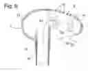 Fig. 05 - Control lever for a vehicle