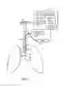 Fig. 02 - Multiple channel tracheal tube placement device and technique for using the same