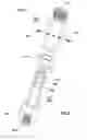 Fig. 06 - Double string pump for hydrocarbon wells