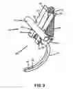 Fig. 10 - Conservation tillage implement, system and method