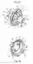 Fig. 02 - GROMMET