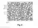 Fig. 06 - Ultrahard sintered carbide particles in hardfacing for earth-boring bit