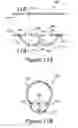 Fig. 08 - Acoustic silencer