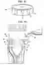 Fig. 13 - Contact lens case