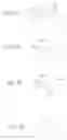 Fig. 04 - Microneedle structure and production method therefor