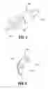 Fig. 10 - Surgical instrument having a plastic surface