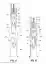 Fig. 14 - Surgical instrument having a plastic surface
