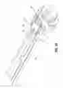 Fig. 19 - Surgical instrument having a plastic surface