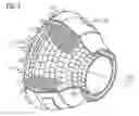 Fig. 04 - Method and device for welding workpieces made of high-temperature resistant super alloys