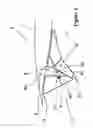 Fig. 04 - Lateral coupling device for holding and guiding at least one aerodynamic body relative to the main wing of an aircraft, airfoil and aircraft with such a lateral coupling device