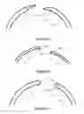 Fig. 06 - Curtain holder