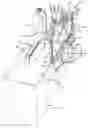 Fig. 01 - Anesthesia equipment lift