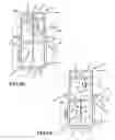 Fig. 04 - Anesthesia equipment lift