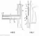 Fig. 06 - Anesthesia equipment lift